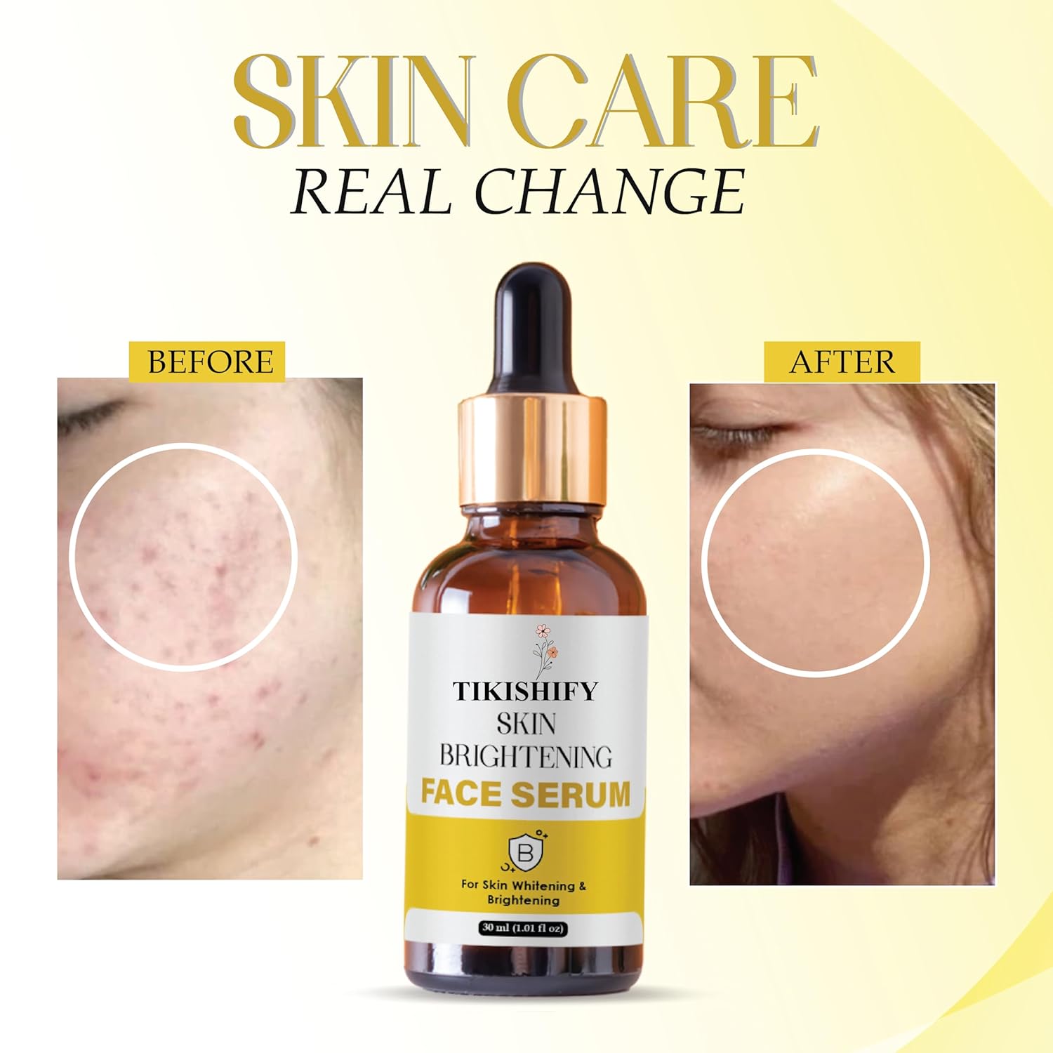 Skin Brightening Face Serum, For Skin Whitening & Brightening, 30ml (1.01 fl oz)